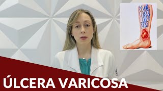 Úlcera varicosa  Dra Nayara Cioffi Batagini  Cirurgia Vascular e Endovascular [upl. by Oramug]