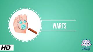 Wart Causes Signs and Symptoms Causes Diagnosis and Treatment [upl. by Amahcen349]