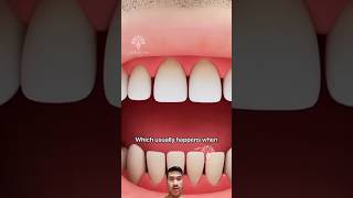 What cause teeth sensitivity 🤯💯💯💯 dentist didyouknow funfacts animation smilecare [upl. by Ecitnerp]