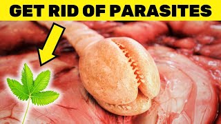 The Hidden Threat of Parasites Powerful Natural Remedies to Get Rid of Them [upl. by Evets766]