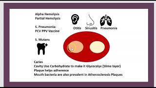 Quels sont les causes du RAA  ASLO Cardite Sydenham Angine Rhumatisme Articulaire Aigu 3 Minutes [upl. by Valenza]