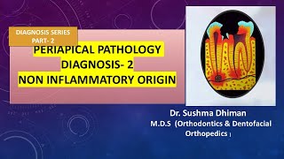 Periapical Pathology  Non inflammatory and non odontogenic lesions [upl. by Emiatej]