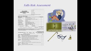 FALL RISK ASSESSMENT FOR OSCE [upl. by Thayer]