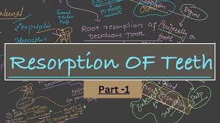 Resorption of Teeth  External Resorption  Internal Resorption [upl. by Adoc]