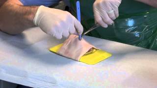 Cricothyroidotomy [upl. by Calmas]