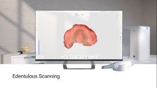 Edentulous Scanning [upl. by Annoyk]