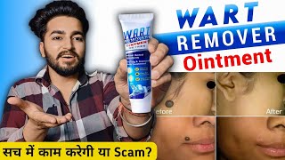 Wart Remover Cream Review  Wart Remover Ointment [upl. by Mcnelly]