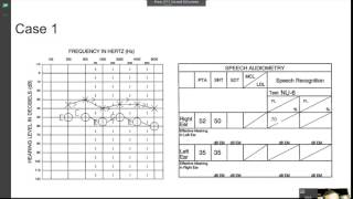 speech audiometry practice [upl. by Wilde]