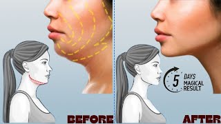 100 EFFECTIVE DOUBLE CHIN FAT amp FACE LIFT  UNIQUE FACIAL EXERCISES [upl. by Tuppeny]