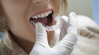 Découvrez les étapes de fabrication de vos aligneurs orthodontiques Primo Orthodontie [upl. by Jenesia387]