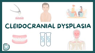 Cleidocranial Dysplasia Causes Diagnosis Types and Management [upl. by Anire921]