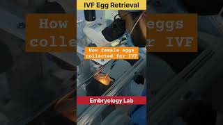 IVF Egg Retrieval by Embryologist ivf fertilitytreatment ivfjourney embryology ivfsuccess [upl. by Llenor969]