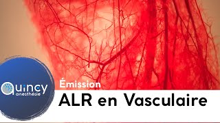 Emission ALR et chirurgie vasculaire 2019 [upl. by Charles822]