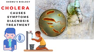 Vibrio cholera causes symptoms prevention and diagnosis [upl. by Farny]