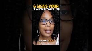 6 Signs You Need a Scalp Detox for Hair Growth  blackhaircare haircare naturalhair [upl. by Eedoj]