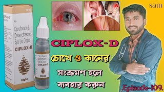 Ciplox D Eye Ear Drops❓Ciprofloxacin Dexamethasone Eye Ear Drops❓Ciplox D Drops [upl. by Lloyd]