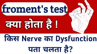 froments sign  froments test  froment sign  Physio Talk [upl. by Ecyak]