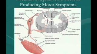 Clinical Significance of Demyelinating Lesions of the Central Nervous System [upl. by Akimot]