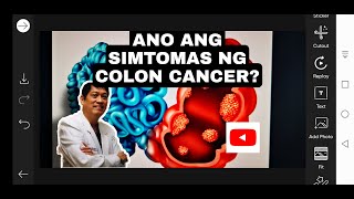 ANO ANG SIMTOMAS NG COLON CANCER [upl. by Phia]