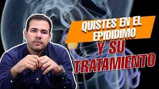 Quistes en los TESTÍCULOS y su tratamiento [upl. by Honna720]