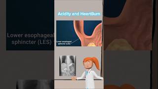 Acidity and HeartBurn youtubeshorts viralvideo fitness motivation ai cartoon animation neet [upl. by Meid]