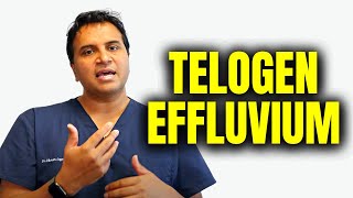 Telogen Effluvium Hair Loss [upl. by Aneet]