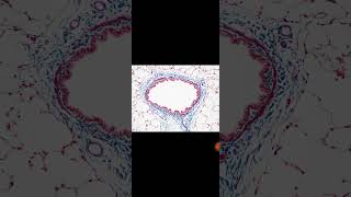 Massons Trichrome staining [upl. by Ryun]