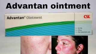 Advantan ointment  Use  Side Effects  Benefits  price review skincare beauty [upl. by Halilahk581]