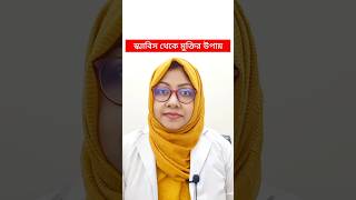 স্ক্যাবিস থেকে মুক্তির উপায় II scabiestreatment treatment [upl. by Glennon]