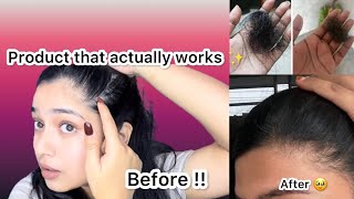 Finally a product that actually works  Solution to your hair problems 🥹❤️  SHEELOVE [upl. by Lebasile82]