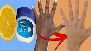 Skin Whitening BY ONLY Vaseline and LEMON  Results In LIVE Video [upl. by Barcot]