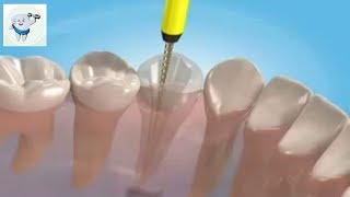 Root Canal Treatment Animation 3D Premolar [upl. by Ulphia547]