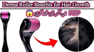 Derma roller 1mm for Hair RegrowthHow to use derma roller for hair growth [upl. by Enitnemelc]