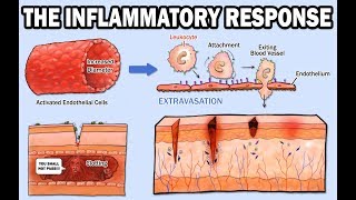 THE INFLAMMATORY RESPONSE [upl. by Draner]