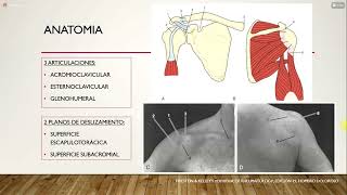 Omalgia  Diagnósticos Diferenciales 11 [upl. by Arreic]