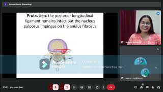 Prolapsed Intervertebral Disc Anatomy of IV Disc Part4 [upl. by Oderfliw831]