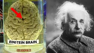 The Unique Brain of Einstein Unraveling the Mystery of Genius einsteinbrain geniusmindset [upl. by Gaves]