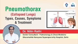 Pneumothorax  Types Causes Symptoms and Treatment  Dr Nitin Rathi [upl. by Nita]