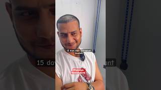 Youtuber Mehtab’s ka Hair Transplant hair hairtreatment shorts [upl. by Naelopan103]