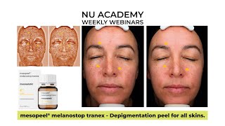 mesopeel® melanostop tranex Depigmentation peel for all skins [upl. by Goff748]