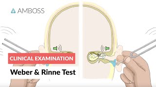 Weber and Rinne Test  Clinical Examination [upl. by Eila]