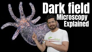 Dark field microscopy explained  Dark field microscope principle [upl. by Mallissa]