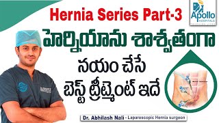 హెర్నియా చికిత్స  Best Treatment for Hernia  Laparoscopic Hernia Repair Telugu  Dr Abhilash Nali [upl. by Winola]