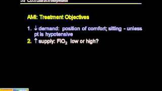 1215 ECG Management of MI [upl. by Irakab273]