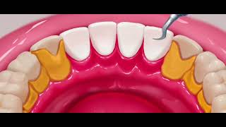 ASMR Satisfying Patient Treatment Dental Care compilation for mood relaxation Tobjerone TV hub [upl. by Hewet]