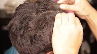 Scalp Scratching  Dandruff Removal Close Up [upl. by Ludeman623]