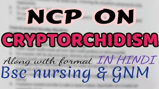 Nursing care plan on CRYPTORCHIDISM child health nursingmedical surgical nursingGNMBSC [upl. by Lenahc]