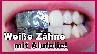 ▶︎ Zähne aufhellen mit Alufolie  es funktioniert [upl. by Ferd757]