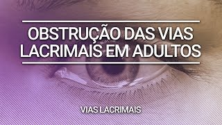 Obstrução das Vias Lacrimais em Adultos  Clínica Dr André Borba [upl. by Icart]