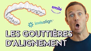 Les GOUTTIERES DALIGNEMENT DENTAIRE Invisalign Smile Direct ClubTout savoir sur lorthodontie [upl. by Nnylarej590]